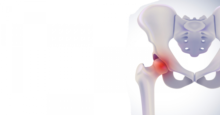 Tree Top Hospital has completed multiple Total Hip Replacement surgery for patients by giving them a new hope in life