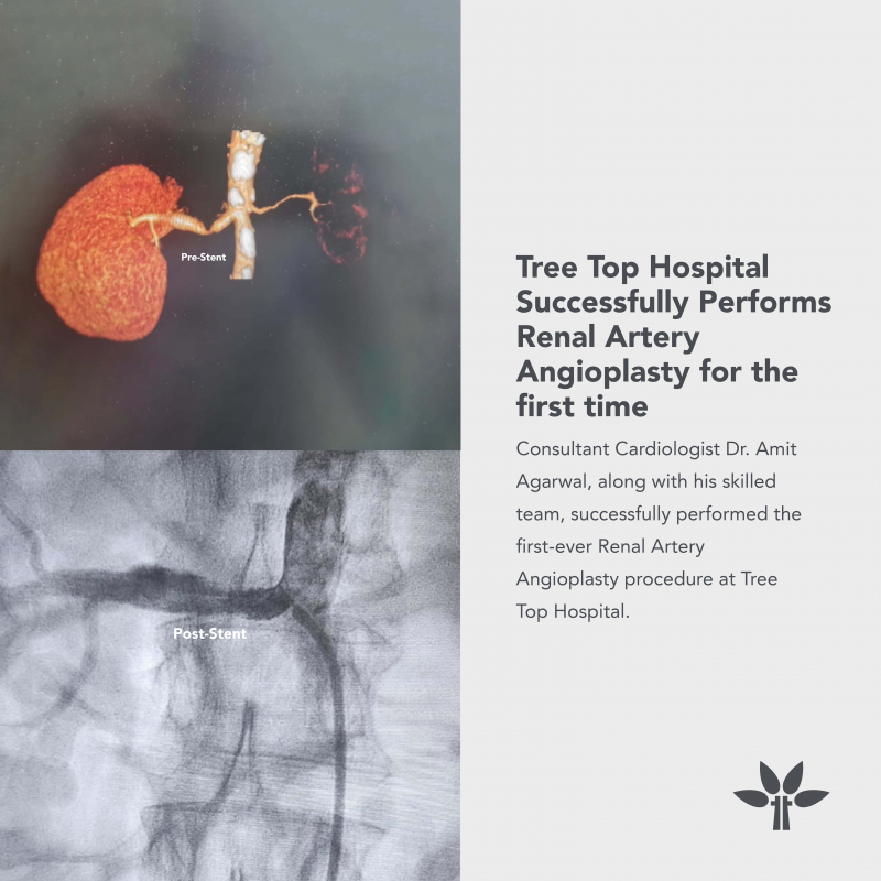 Tree Top Hospital successfully performs renal artery angioplasty for the first time 