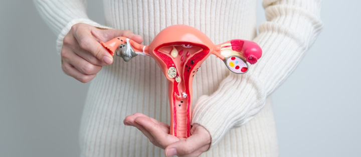 Understanding PCOS and Its Impact on Fertility