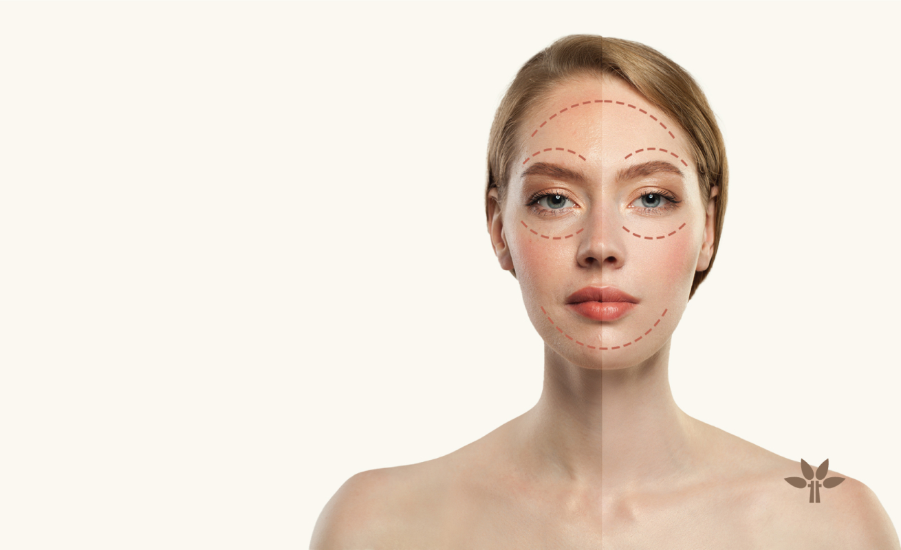 Dermaesthetic Laser Treatments