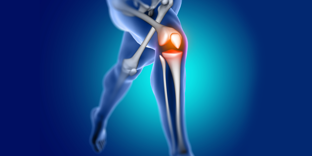 Platelet-Rich-Plasma (PRP) Therapy for Orthopedics